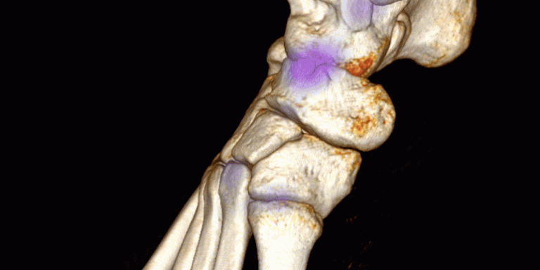 Home Nuclear Medicine Blog